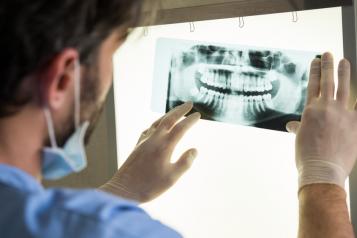 Dentist looking at a dental x-ray